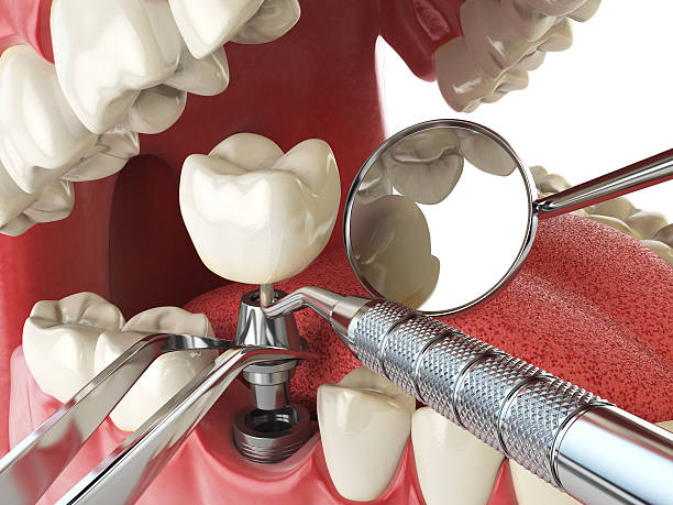 Best Emergency Treatment for Oral Infections in Packanack Lake, NJ
